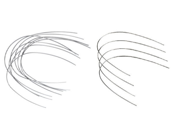 archwire