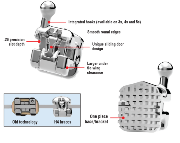 self ligating bracket