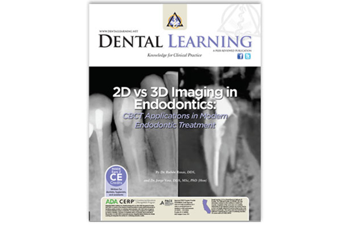2D vs 3D Imaging in Endodontics: CBCT Application in Modern Endodontic Treatment